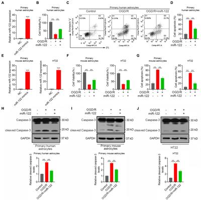 MiR-122 overexpression alleviates oxygen–glucose deprivation-induced neuronal injury by targeting sPLA2-IIA